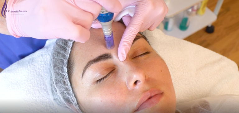 Curs de microneedling: teorie si practica curs de microneedling practica
