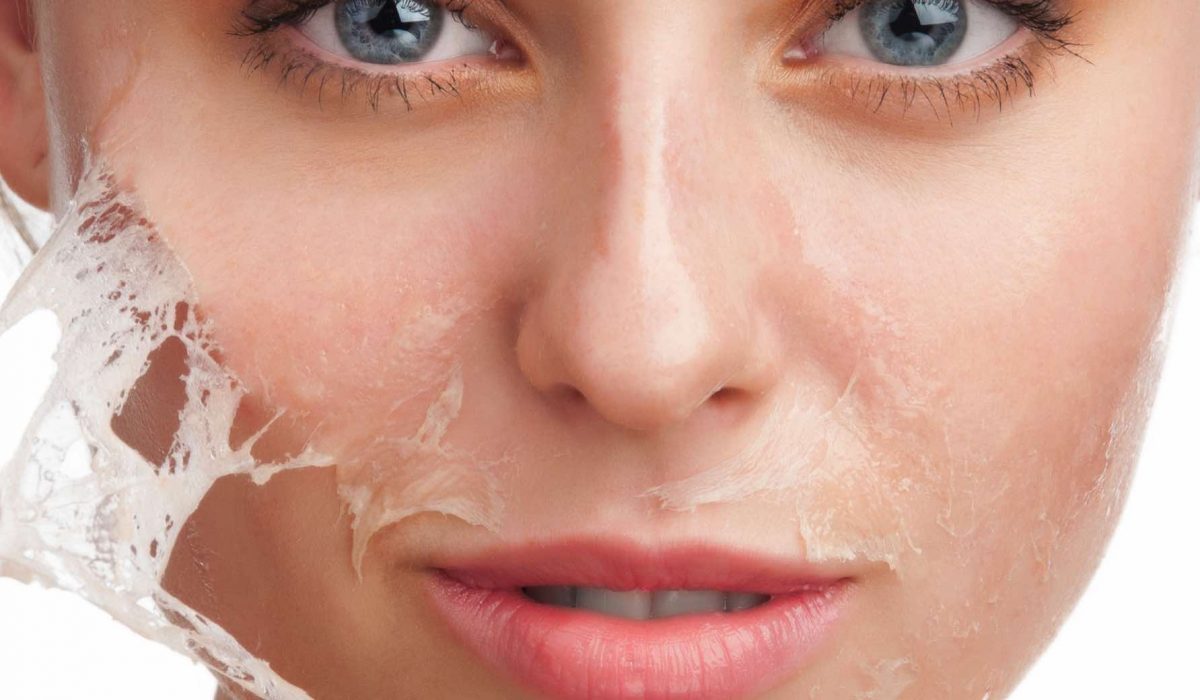 Despre peeling chimic, o vedeta a sezonului rece